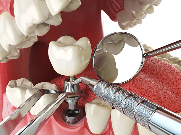 Best Tooth Pain Emergency Relief  in South Bloomfield, OH